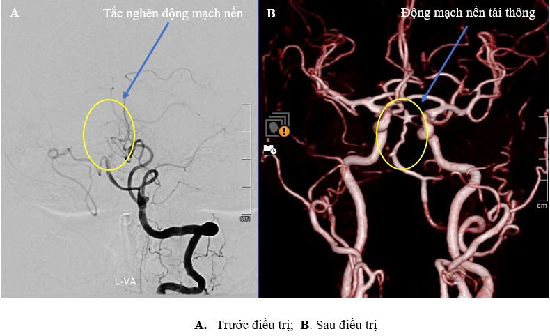 truoc-va-sau-dieu-tri-1733391045.jpg