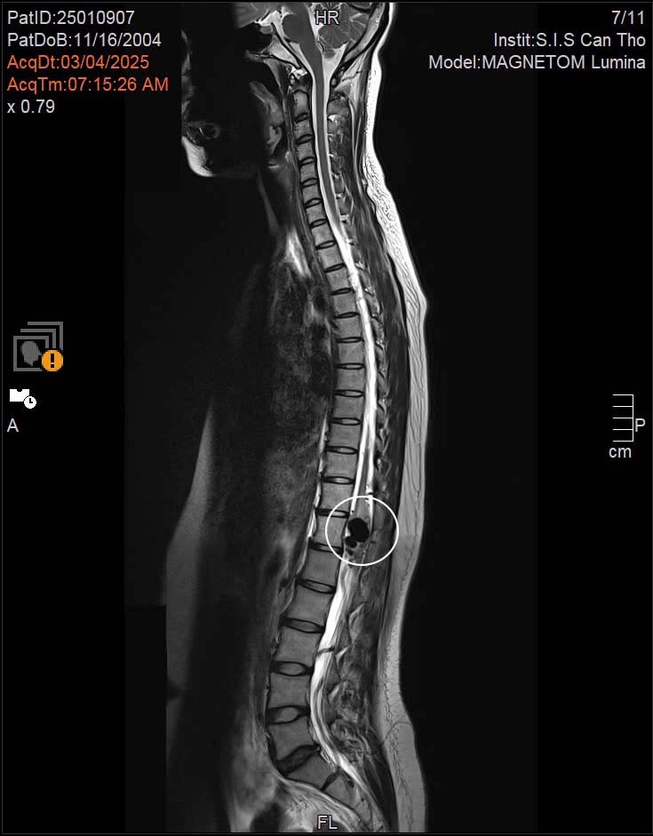 hinh-chup-mri-cot-song-1747101553.jpg