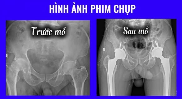 benh-vien-115-nghe-an-2-1753323292.jpg