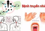 Bộ Y tế ban hành danh mục mới về bệnh truyền nhiễm