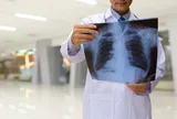 Ho kéo dài, khạc đờm mỗi sáng có thể là dấu hiệu sớm của bệnh phổi tắc nghẽn mạn tính