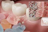 Nhật Bản nghiên cứu kẹo dẻo chứa lợi khuẩn giúp cải thiện bệnh viêm nướu