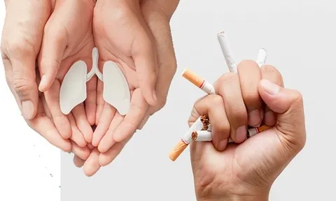 Điều trị cai thuốc lá bằng y học cổ truyền