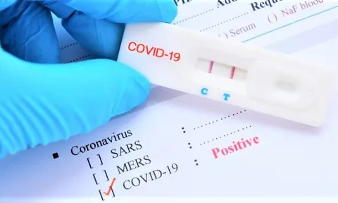 Xem xét đưa kit xét nghiệm Covid -19 vào diện bình ổn giá