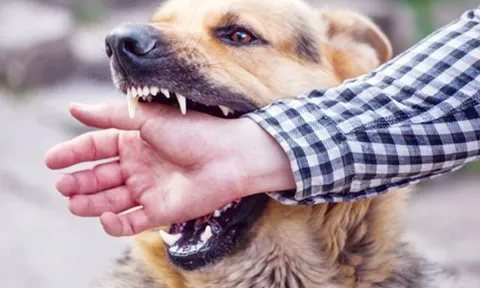 Bé 5 tuổi ở Quảng Trị tử vong sau 1 tháng bị chó thả rông cắn