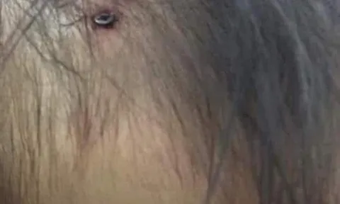 Xuất hiện hình ảnh nghi là bé gái 3 tuổi ở Hà Nội với chiếc đinh lớn cắm thẳng vào đầu khiến dân mạng dậy sóng