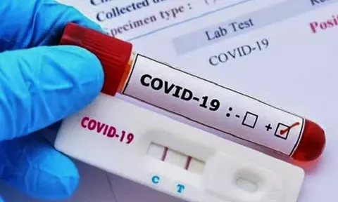 Nhu cầu test COVID-19, máy SpO2 tăng cao, Bộ Y tế yêu cầu đảm bảo nguồn cung