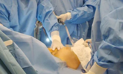 Hậu quả chết người do phẫu thuật thẩm mỹ chui: Bài học đắt giá vì mê làm đẹp