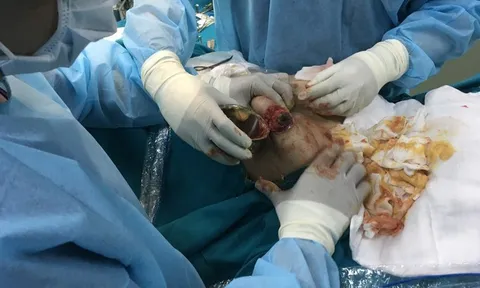 Cảnh báo tình trạng biến chứng nguy hiểm từ việc đi làm đẹp tại cơ sở thẩm mỹ "chui"