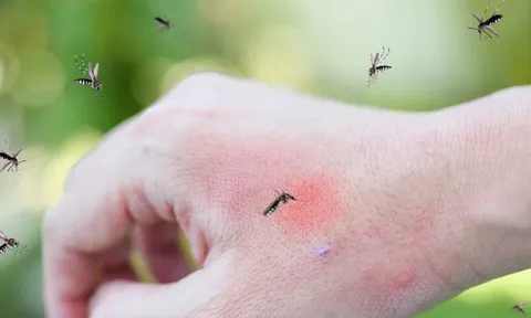 Cảnh báo TP.HCM có thể bùng phát dịch sốt xuất huyết vào cuối năm