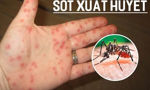 Dịch sốt xuất huyết bùng phát, Thủ tướng Chính phủ yêu cầu tăng cường phòng, chống