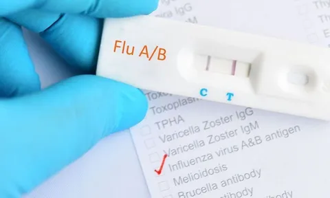 Kit test cúm A loạn giá thị trường, chuyên gia khuyến cáo