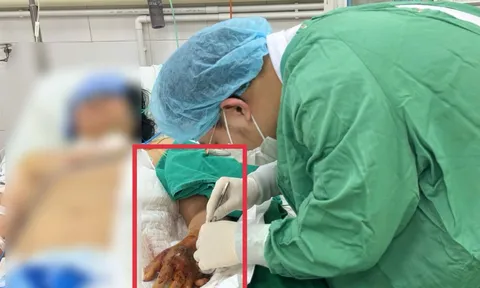 Sốc nhiễm khuẩn nặng sau khi tiêm thuốc ở phòng khám tư