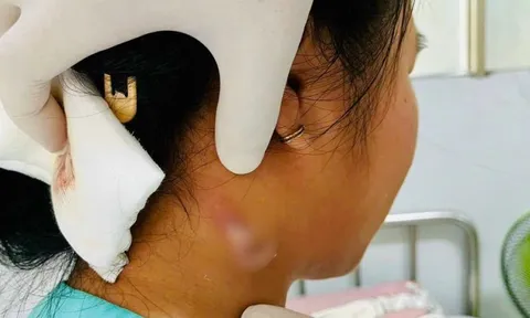 Vi khuẩn "ăn thịt người" nguy hiểm ra sao mà ai cũng phải sợ?