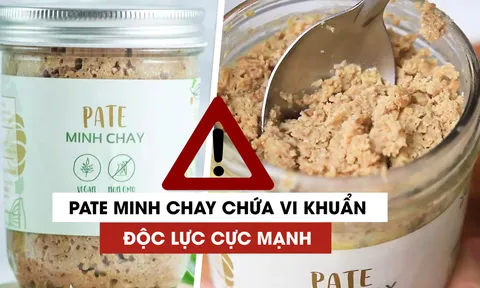 Cứu sống 2 bệnh nhân ngộ độc patê chay nhờ huyết thanh kháng độc tố