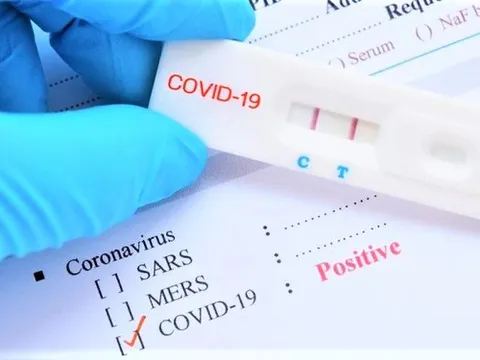 Xem xét đưa kit xét nghiệm Covid -19 vào diện bình ổn giá