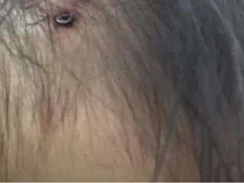 Xuất hiện hình ảnh nghi là bé gái 3 tuổi ở Hà Nội với chiếc đinh lớn cắm thẳng vào đầu khiến dân mạng dậy sóng