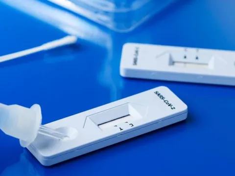 Chuyên gia: Test định kỳ 2 lần/tuần không có ý nghĩa