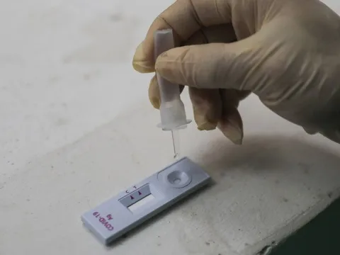 Cảnh báo: Kit test nhanh COVID có hoá chất nguy hiểm, người dân cần thận trọng