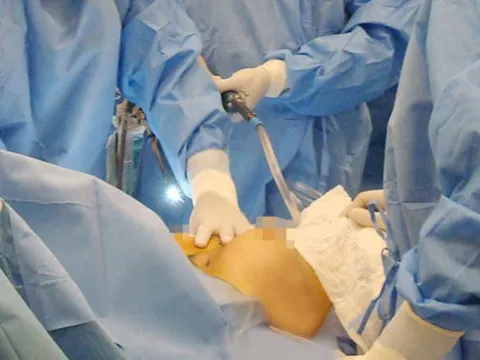 Hậu quả chết người do phẫu thuật thẩm mỹ chui: Bài học đắt giá vì mê làm đẹp