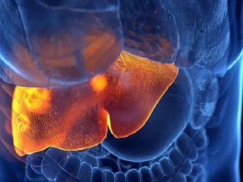 Các dấu hiệu cảnh báo viêm gan bí ẩn ở trẻ cha mẹ cần lưu ý