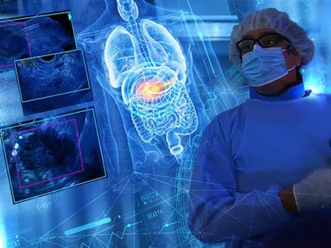 Ứng dụng thành công phần mềm AI phát hiện các bệnh tuyến tụy