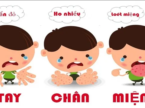 Bộ Y tế cảnh báo xu hướng gia tăng ca tay chân miệng