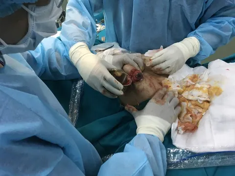 Cảnh báo tình trạng biến chứng nguy hiểm từ việc đi làm đẹp tại cơ sở thẩm mỹ "chui"