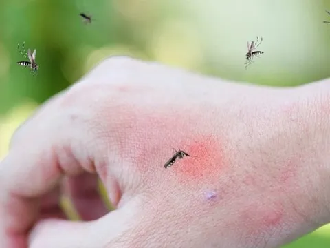 Cảnh báo TP.HCM có thể bùng phát dịch sốt xuất huyết vào cuối năm