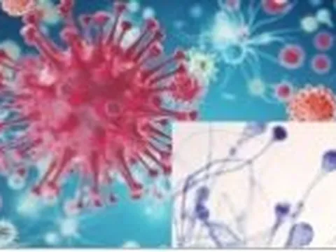 Hai người tổn thương hàm mặt dẫn đến tử vong là do nhiễm nấm đen?