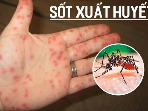 Dịch sốt xuất huyết bùng phát, Thủ tướng Chính phủ yêu cầu tăng cường phòng, chống