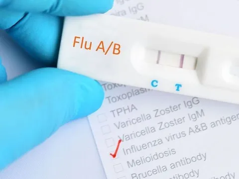 Kit test cúm A loạn giá thị trường, chuyên gia khuyến cáo