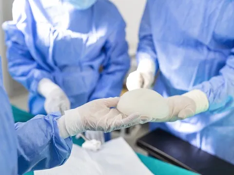 FDA cảnh báo: Túi nâng ngực có khả năng gây ung thư