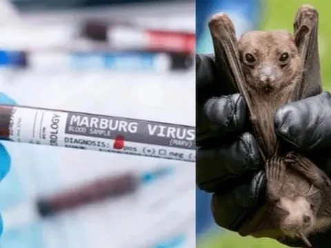 Bộ Y tế: Tăng cường kiểm dịch y tế, năng lực xác định với bệnh Marburg