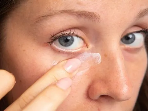 Thiếu sắt có thể gây ra một số vấn đề sức khỏe về mắt