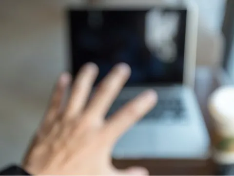 TP. Hồ Chí Minh: Cấp cứu bệnh nhân người Campuchia bị mờ mắt đột ngột do viêm xoang biến chứng