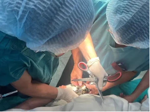 Tò mò nghịch ổ khóa, bé trai 5 tuổi suýt mất ngón tay cái