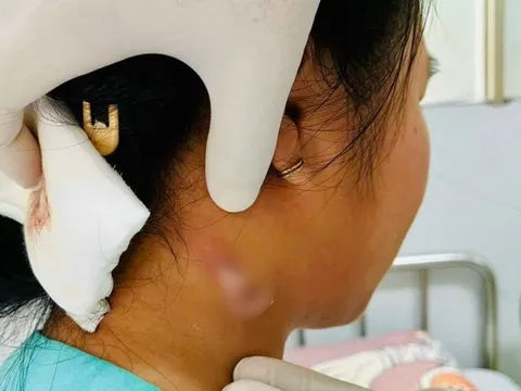 Vi khuẩn "ăn thịt người" nguy hiểm ra sao mà ai cũng phải sợ?