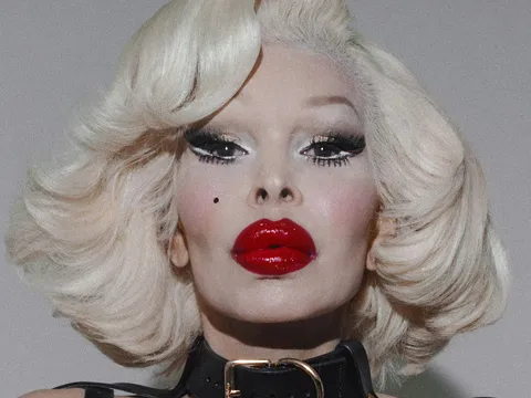 Người phụ nữ từng rất nóng bỏng này là “thảm họa thẩm mỹ đáng tiếc nhất”