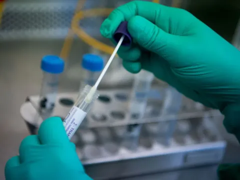 Bộ Y tế đề nghị thanh tra việc nhập khẩu, mua sắm test kit Covid-19