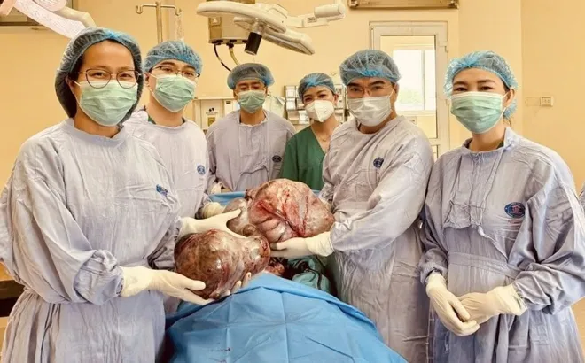 Cô gái H’Mông 16 tuổi được cứu khỏi khối u buồng trứng gần 15kg