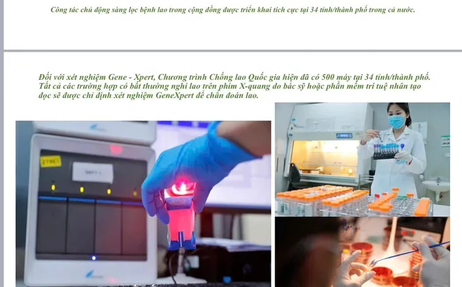 Việt Nam hưởng ứng Ngày Thế giới phòng chống lao